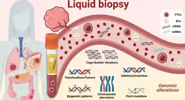 Blogs: liquid biopsy