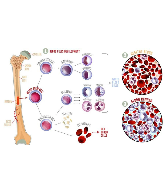 Bone marrow transplantation unit